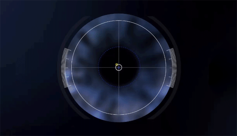 CentraLign 중심축 정렬