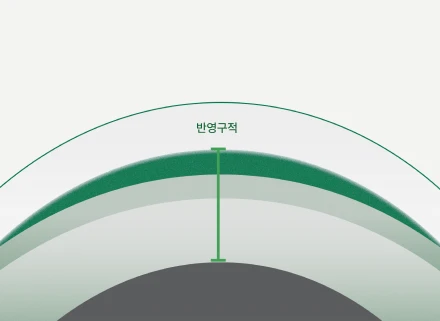 반영구적 시력 교정